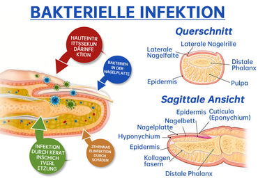 PureNail | Fungal laser therapy device - your secret weapon against nail fungus