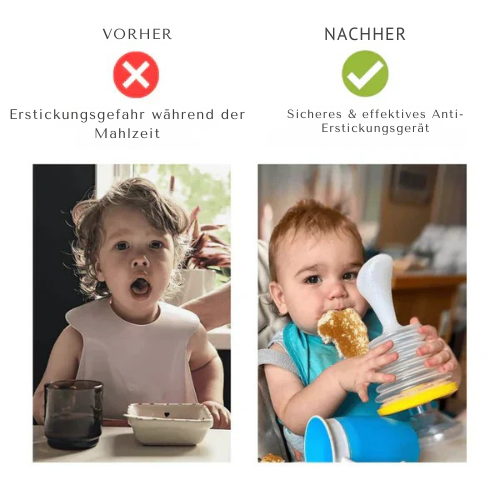 Sunabz™ANTI-CHOKING DEVICE